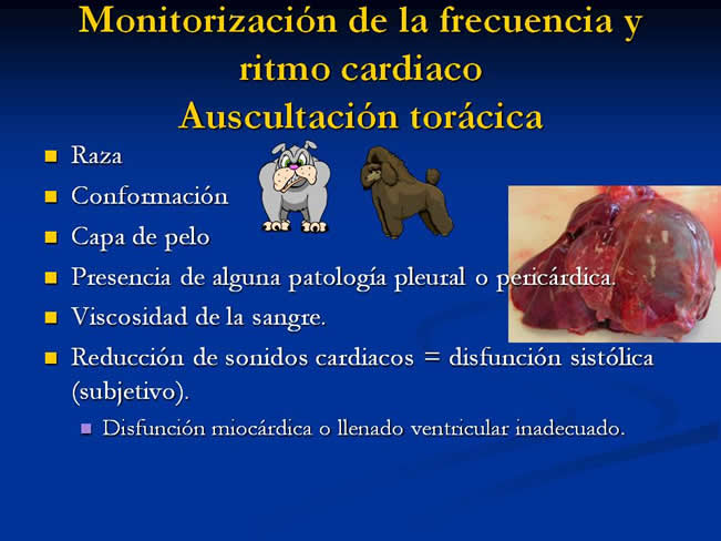 Monitorización del paciente en estado crítico y anestesia
