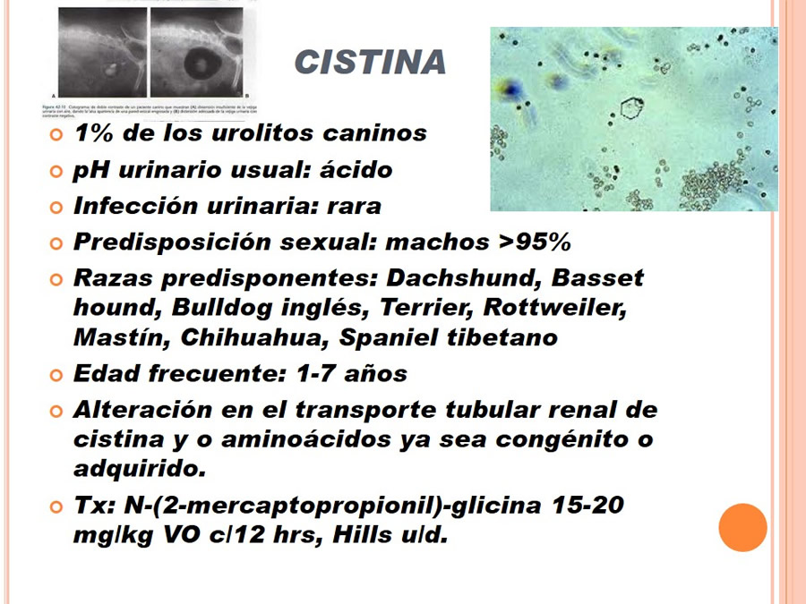 Caso Clínico, Urolitiasis